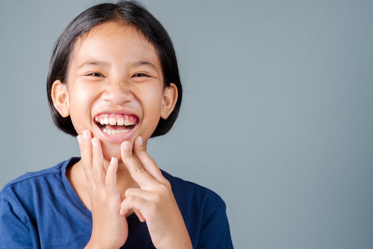 Laughing girl with a gummy smile