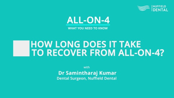 All-on-4: Replacing Several Missing Teeth Nuffield Dental